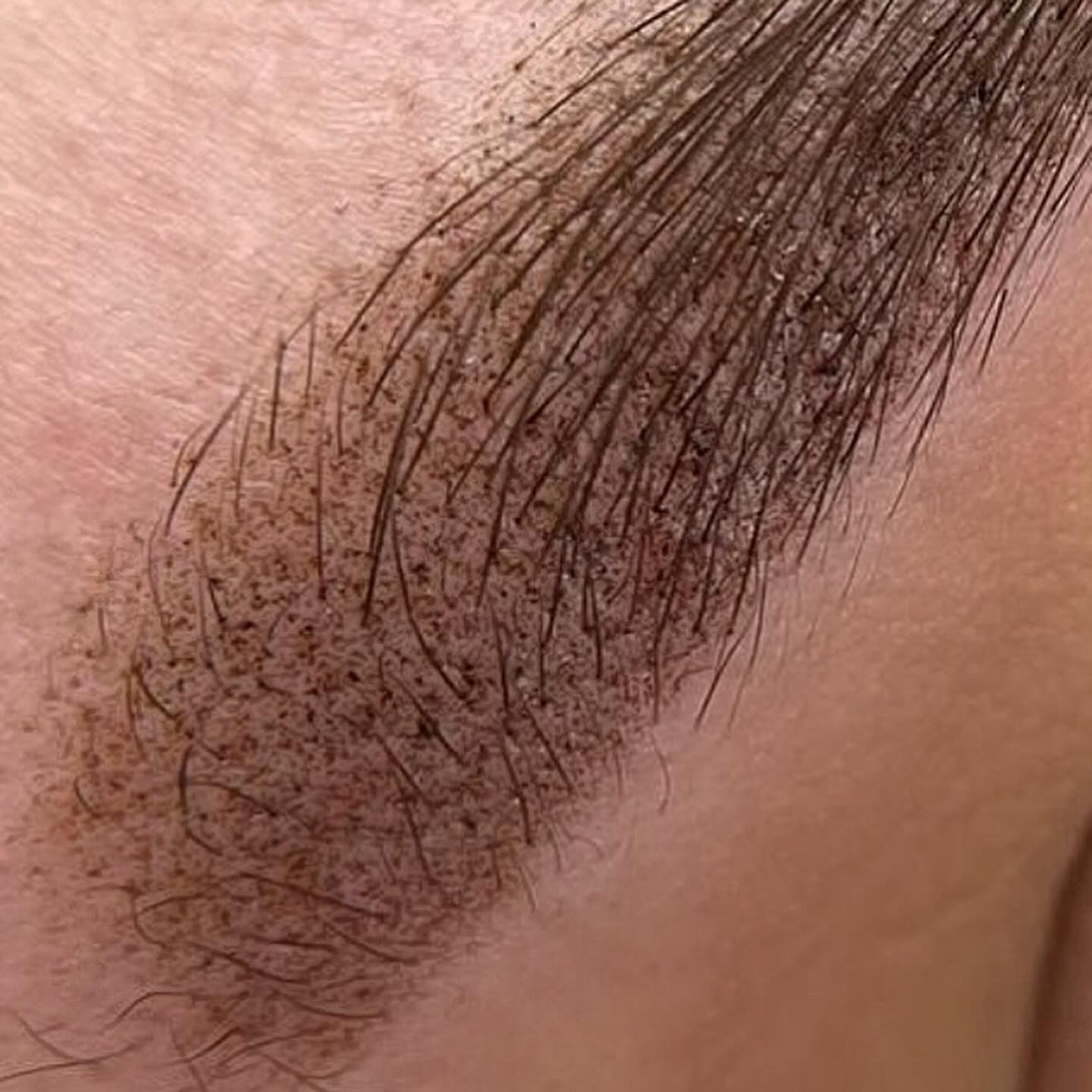 Permanent Make-up der Augenbrauen — feine Härchen-Striche, frisch gesetzt