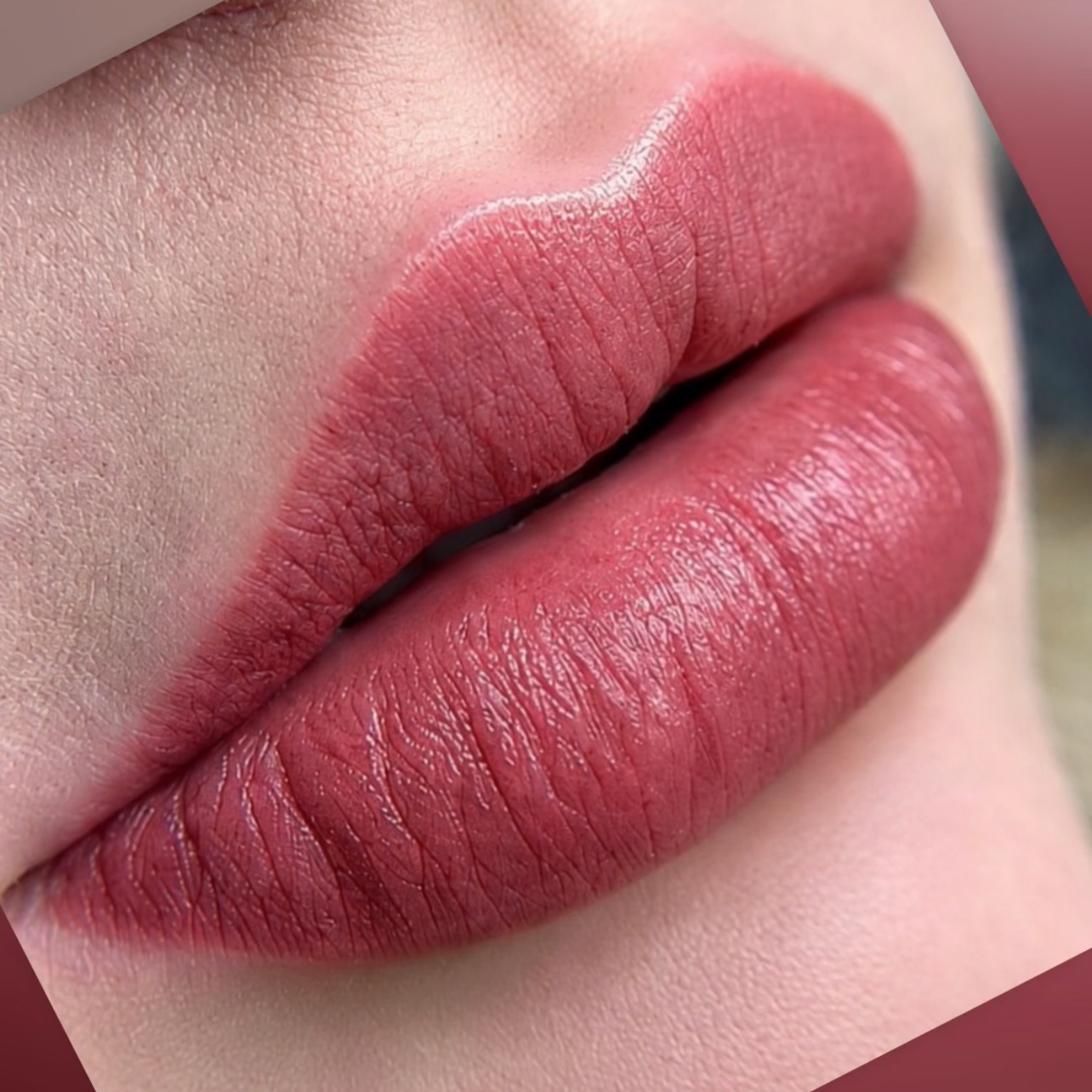 Abgeheilte Lippenpigmentierung mit voller, gepflegter Lippenkontur