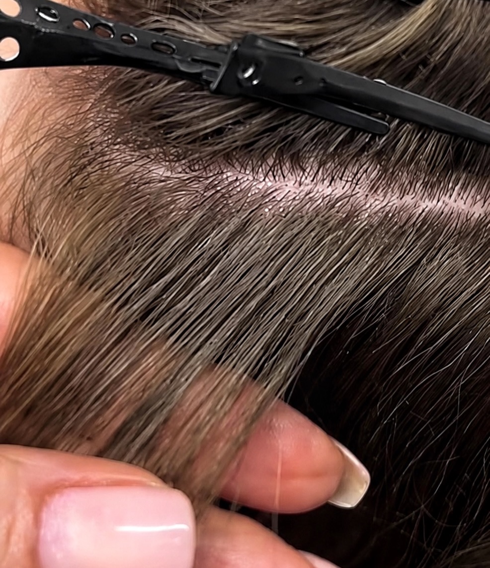 Eingearbeitete Echthaar-Extensions am Haaransatz im Detail